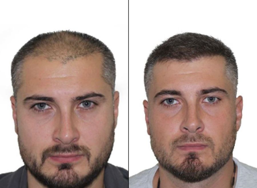 Клиника по пересадке волос